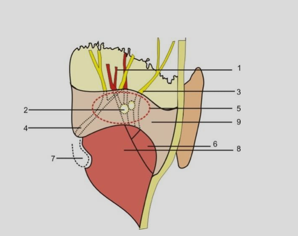 Minimally invasive traditional Chinese medicine treatment of migraine based on the release of the occipital tendon arch